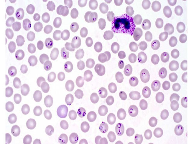 Haematology