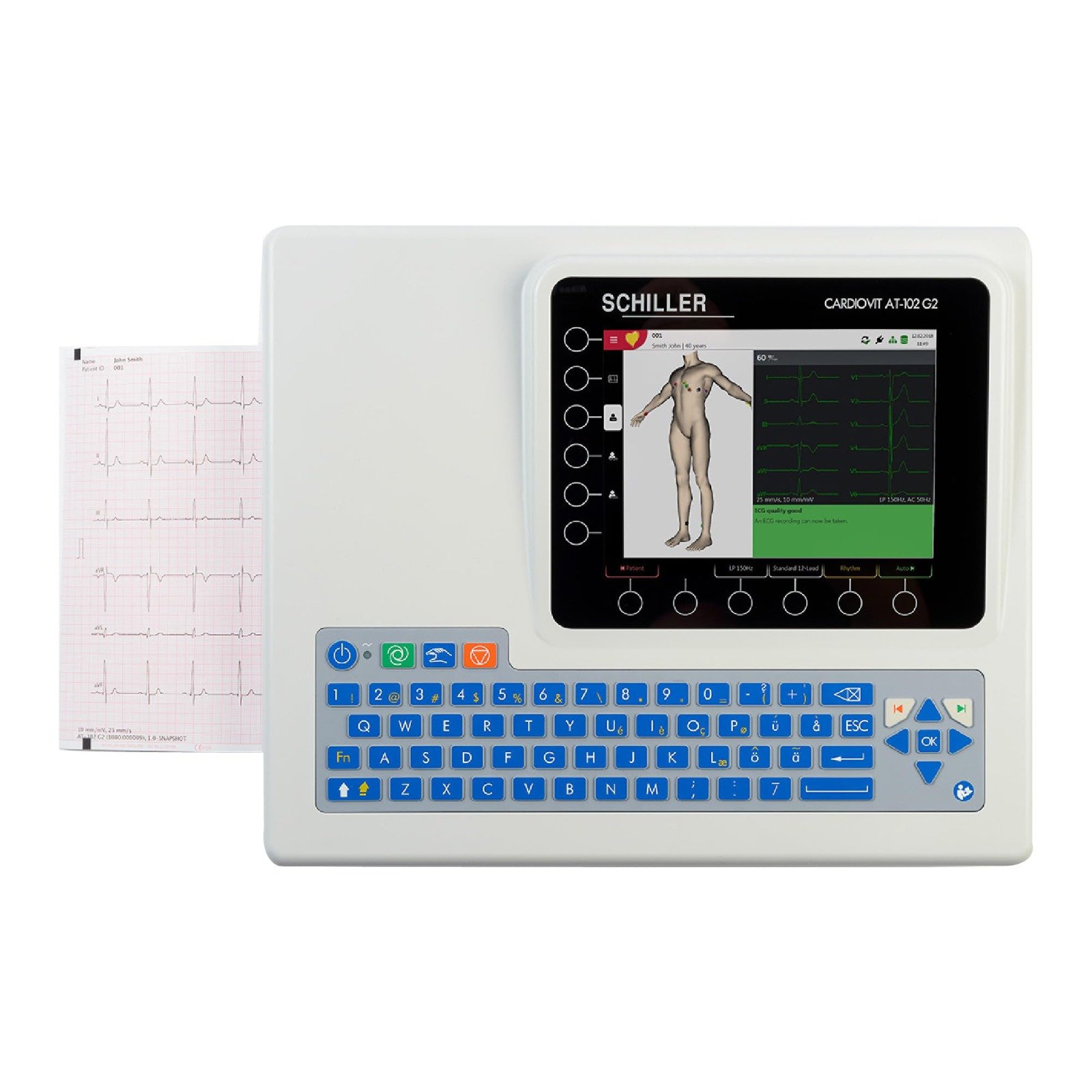 ECG